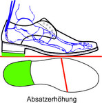 Durch eine einseitige Erhöhung wird die fehlende Beinlänge ausgeglichen. Damit wird das Becken gerade gestellt und ein vorzeitiger Verschleiß der Wirbelsäule vermieden.