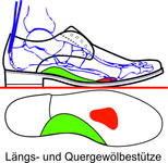 wie bei der orthopädischen Einlage werden die beiden Fußgewölbe entsprechend aufgerichtet und abgestützt. Vorteil gegenüber der losen Einlageist, das diese in offenen Schuhe die nicht für Einlagen geeignet sind fest eingearbeitet werden und keinen z