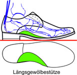 wie bei der orthopädischen Einlage wird das Längsgewölbe Aufgerichtet und Abgestützt. Vorteil gegenüber der losen Einlage ist, das diese in offenen Schuhe die nicht für Einlagen geeignet sind fest eingearbeitet werden und keinen zusätzlichen Platz 