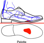 wie bei der orthopädischen Einlage wird das Quergewölbe Ausgerichtet und Abgestützt. Vorteil gegenüber der losen Einlage ist, das diese in offenen Schuhe die nicht für Einlagen geeignet sind fest eingearbeitet werden und keinen zusätzlichen Platz be